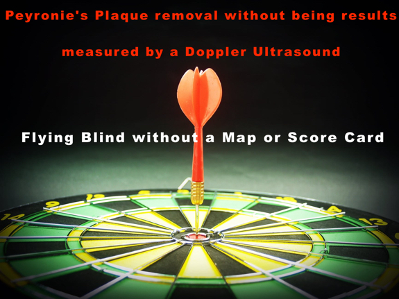 peyronies-disease-latest-treatment-solution